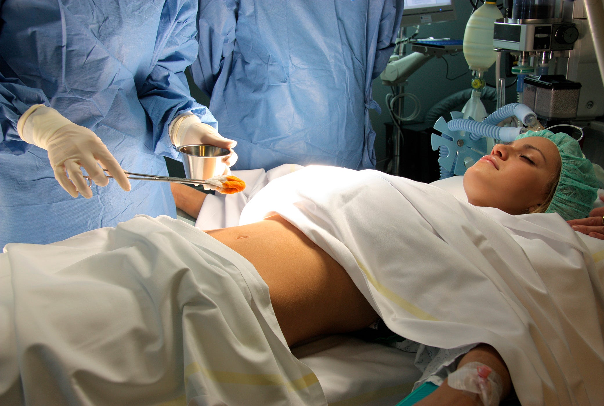 Hérnia Abdominal e o Uso da Tela Cirúrgica: O Que Você Precisa Saber, Segundo o Dr. Vitor Neves