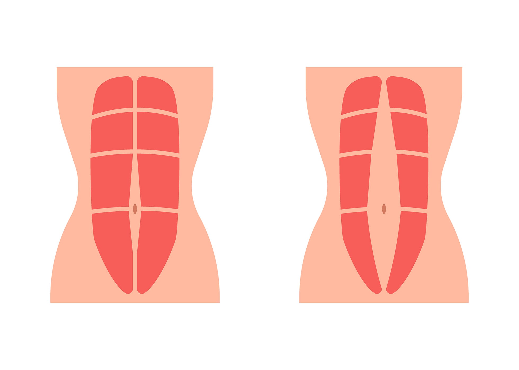 Diástase Abdominal: Quando Procurar um Cirurgião?